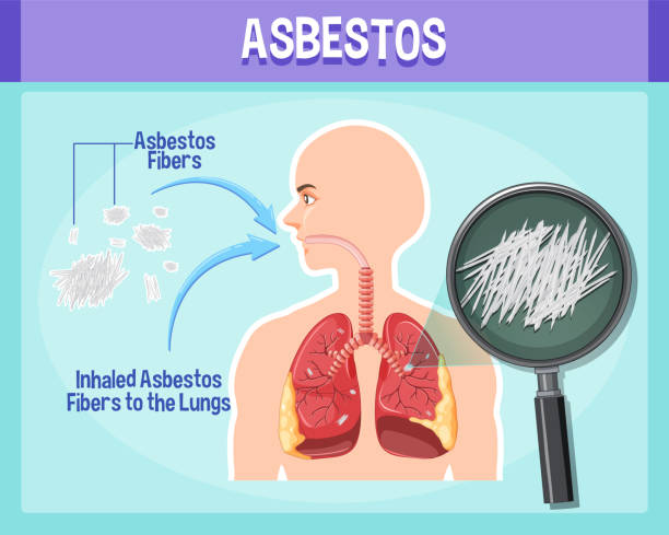 asbestos-mesothelioma